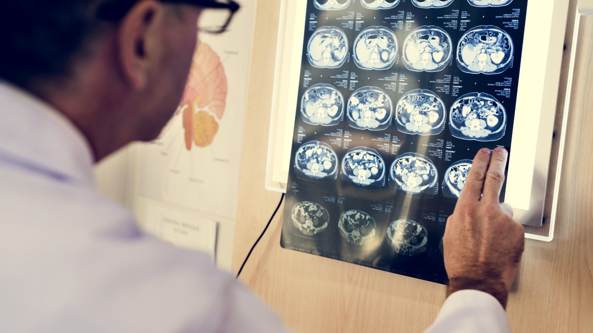 Los neurólogos advierten que ninguna cirugía puede curar la migraña